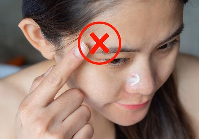 Nhiều người gặp tình trạng mốc trắng mặt sau khi sử dụng kem chống nắng vật lý. Ảnh minh họa: Internet